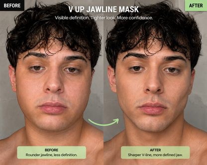 Jawlin™ Cooling V-Up De-Puffing Mask